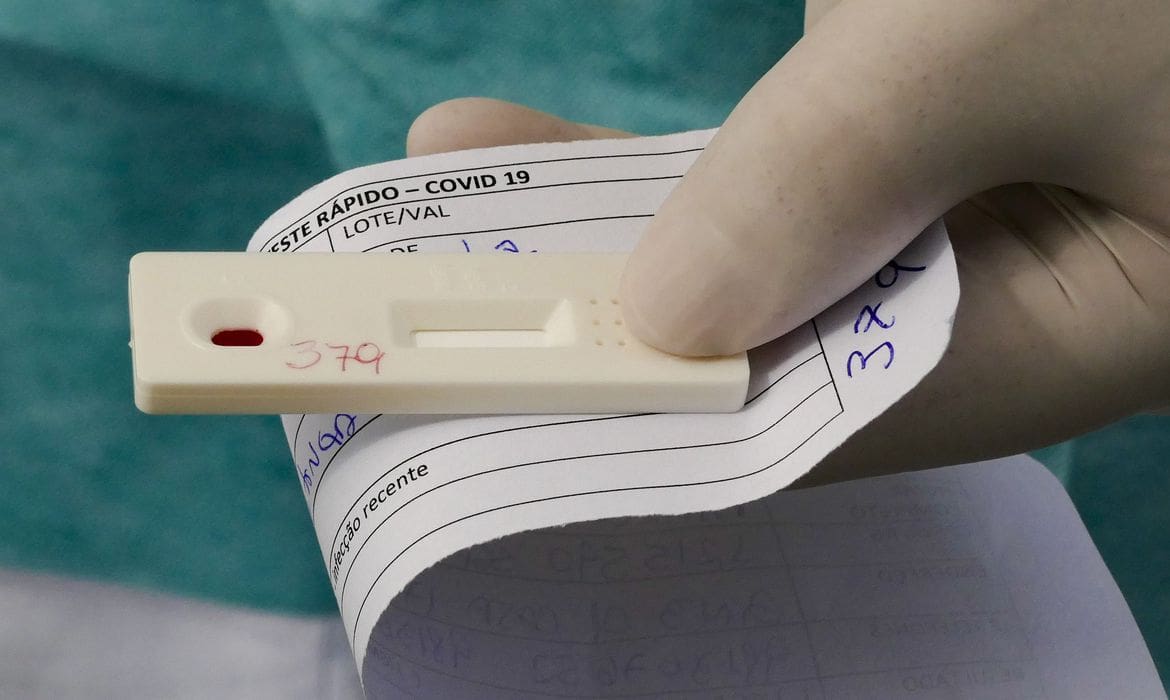 Prefeitura garante regularização de testes da Covid-19 nas unidades de saúde de Divinópolis