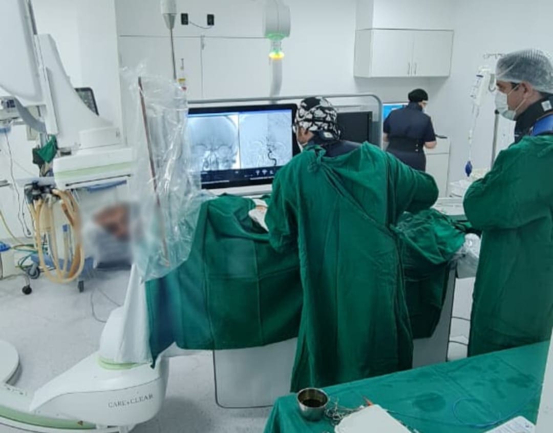Santa Casa de Oliveira realiza primeira retirada mecânica de um trombo cerebral para tratamento de AVC pelo SUS