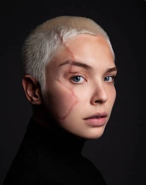 Modelo com cicatriz no rosto vira rosto de campanha de beleza