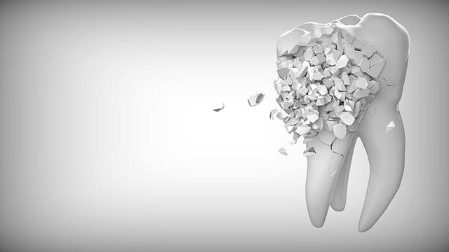 https://pixabay.com/pt/photos/dente-odontologia-divers%c3%a3o-dentista-2874551/