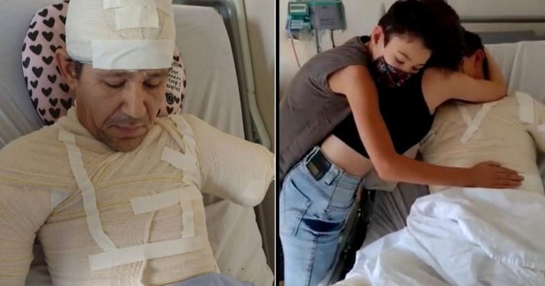 Amigos se unem em campanha para conseguir prótese para pintor que perdeu os braços
