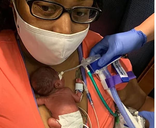 Bebê de 19 semanas se transforma no mais prematuro do mundo