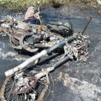 Após 2 meses do grave acidente na BR 494, vítima faz nova cirurgia e retorna para o CTI