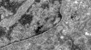 Covid-19: o que se sabe at&eacute; agora da variante &Ocirc;micron