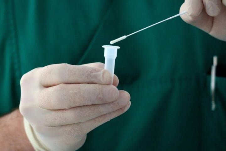 Anvisa regulamenta a utilização de autotestes para Covid-19