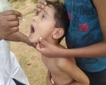 Divinópolis volta a realizar mutirão de vacinação para ampliar a cobertura vacinal contra poliomielite
