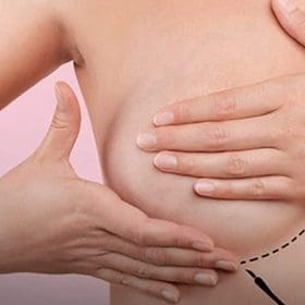 Outubro Rosa: Autocuidado é ferramenta importante na prevenção do câncer de mama