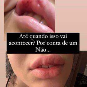 DJ de Divinópolis é agredida após se recusar a beijar homem em festa