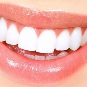 Rápidos resultados colocam o clareamento dos dentes como um dos procedimentos estéticos mais aplicados