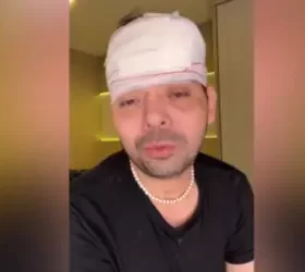 Gustavo Mendes, que imita Dilma, é agredido durante roubo em Juiz de Fora