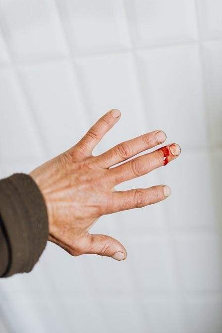 Rascunhos da Vida: Cortei meu dedo&hellip;