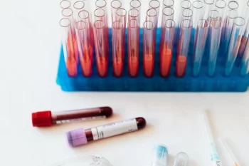 Farm&aacute;cias e consult&oacute;rios m&eacute;dicos poder&atilde;o realizar exames de laborat&oacute;rio