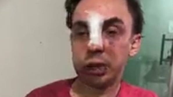 TJMG concede liberdade provisória ao acusado de agredir Secretário de Divinópolis
