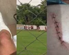 Briga generalizada em campo de futebol de Divinópolis deixa dois feridos