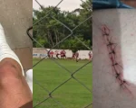 Briga generalizada em campo de futebol de Divinópolis deixa dois feridos