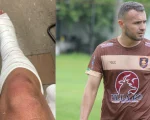 Jogador ferido em briga generalizada em Divinópolis passará por cirurgia