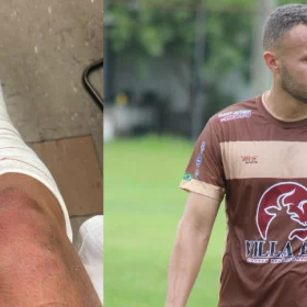 Jogador ferido em briga generalizada em Divinópolis passará por cirurgia