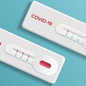 Prefeitura de Divinópolis compra 2500 testes de Covid-19 sem licitação; município emite nota