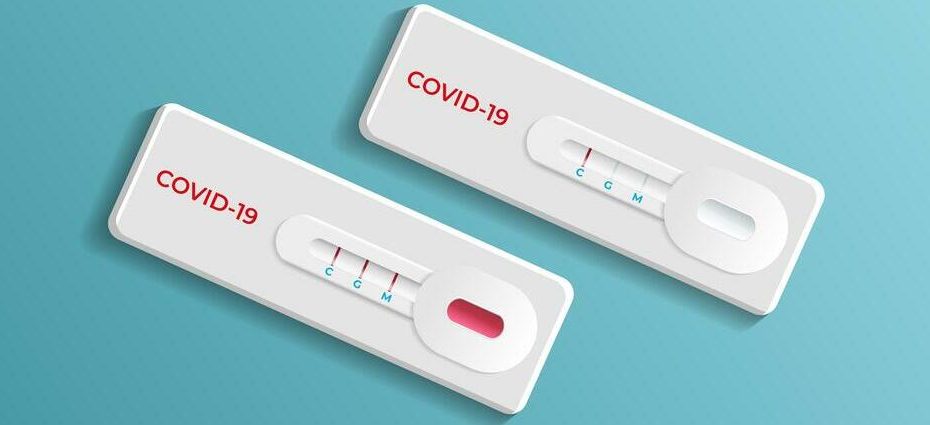 Prefeitura de Divinópolis compra 2500 testes de Covid-19 sem licitação; município emite nota