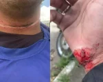Motociclista fica ferido após ser atingido por fios soltos na av. JK em Divinópolis
