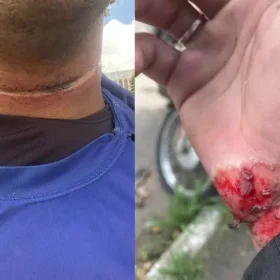 Motociclista fica ferido após ser atingido por fios soltos na av. JK em Divinópolis