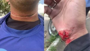 Motociclista fica ferido ap&oacute;s ser atingido por fios soltos na av. JK em Divin&oacute;polis