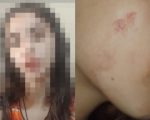 Adolescente denuncia agressão na Casa Maria Paola, em Divinópolis