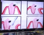 Especialista explica como o tratamento de aumento da coroa clinica pode ser eficiente em alguns casos