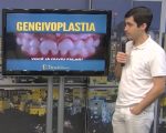 O que é a gengivoplastia, e quando ela é indicada? Quadro especial do Bom Dia responde essas dúvidas