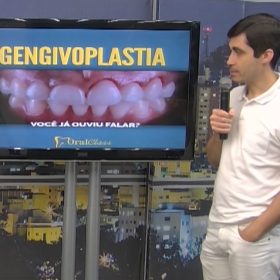 O que é a gengivoplastia, e quando ela é indicada? Quadro especial do Bom Dia responde essas dúvidas
