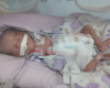 Família pede doação de sangue para recém-nascida internada em Formiga