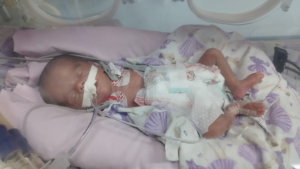 Família pede doação de sangue para recém-nascida internada em Formiga