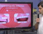 Entrevista: Veja os benefícios e quando o clareamento interno é indicado