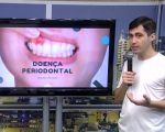 Especialista explica as causas e conseqüências da doença periodontal