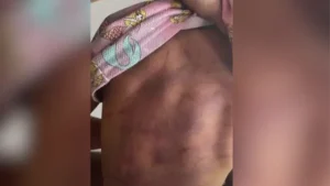 Piumhi: Mulher aciona a PM ap&oacute;s filha ser espancada pelo pai