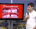 Frenectomia: o que é e para quem esse procedimento é indicado