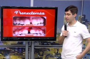 Frenectomia: o que &eacute; e para quem esse procedimento &eacute; indicado