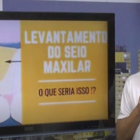 Especialista tira dúvidas sobre o procedimento de levantar o seio maxilar