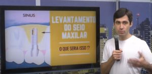 Especialista tira d&uacute;vidas sobre o procedimento de levantar o seio maxilar