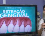 Especialista explica sintomas e tratamentos da retração gengival