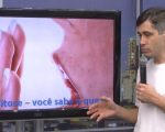 Halitose o que é e como tratar é tema, veja opinião de especialista