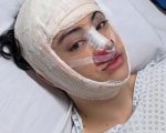 Influenciador Zé Longuinho faz cirurgia de feminização facial