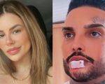 Lorena Marcondes é condenada em caso de modelo que teve a boca deformada