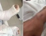 Mulher pula de prédio para escapar de agressões do marido e sobrevive com múltiplas fraturas na Grande BH