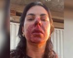 No dia da mulher, Oficial de Justiça é agredida em serviço por PM, suspeito é preso
