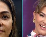 Suzana Alves, a eterna Tiazinha, passa por harmonização facial e revela resultado