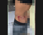 Mulher é agredida por ex-companheiro e atual namorado é atacado por cachorro durante confusão em Formiga