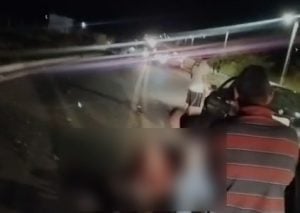 Motociclista tem perna amputada ap&oacute;s acidente com carro em Nova Serrana