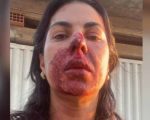 PM que agrediu oficial de justiça no dia das mulheres é condenado, mas vai recorrer em liberdade