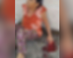 Divinópolis: Idosa ferida após tropeçar em cabos, quebrou o fêmur e ainda não teve dedos reimplantados